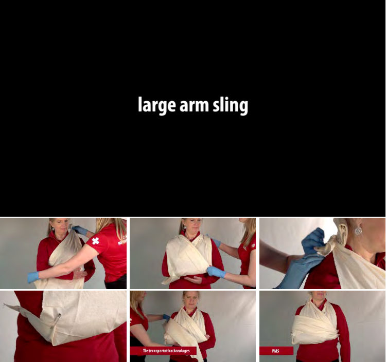 Figure 13-19: Large arm sling